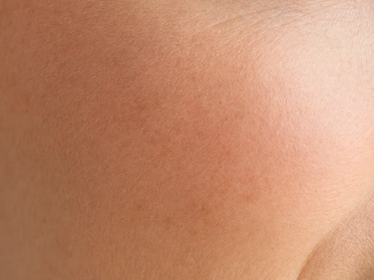 Close-up of uneven skin tone and texture