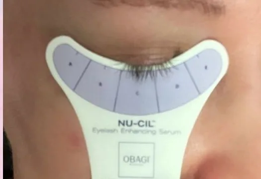 Before: Nu-Cil eyelash serum at Vero Beach Medical Spa